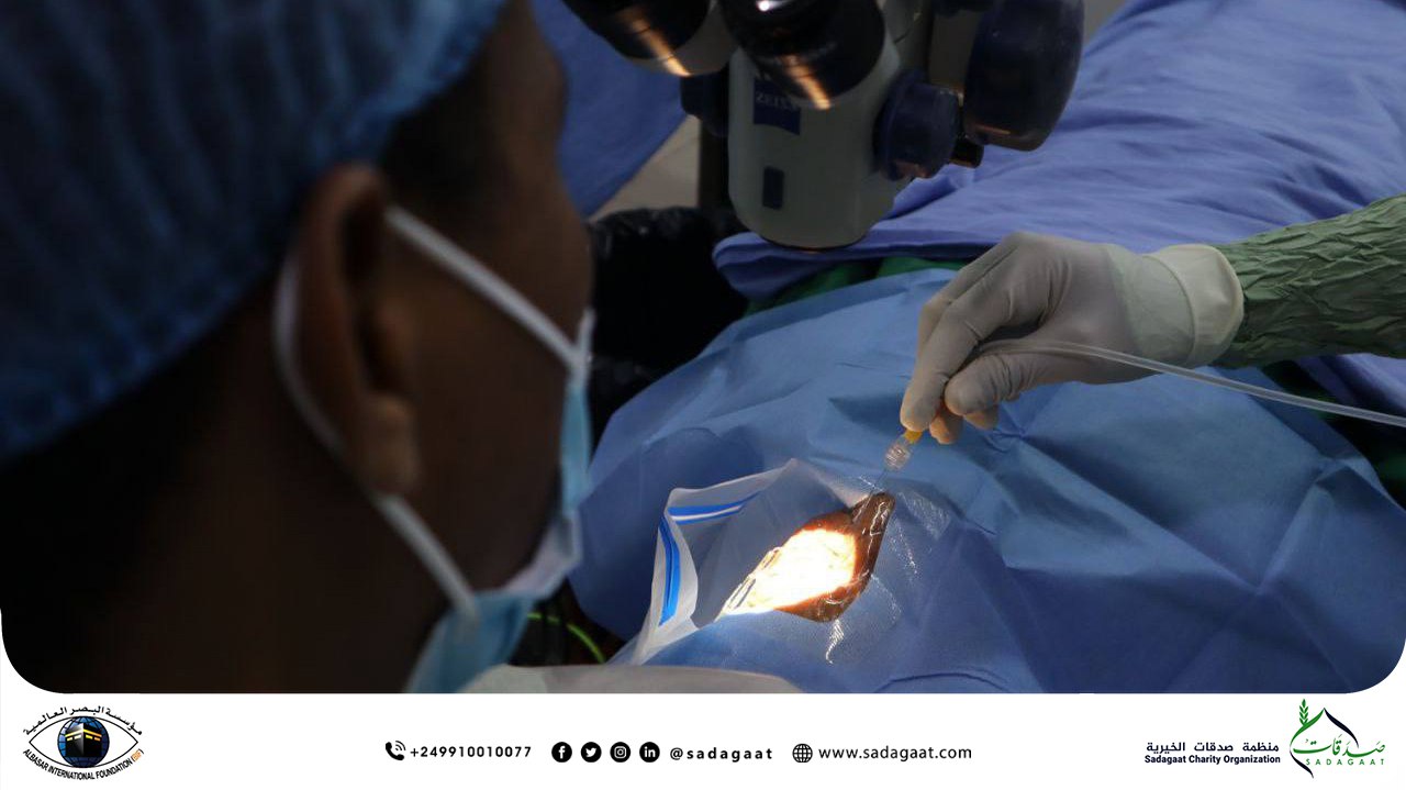 100 Free Cataract Surgeries